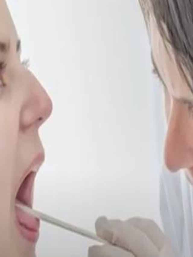 Why doctor checks patient tongue while check up…?